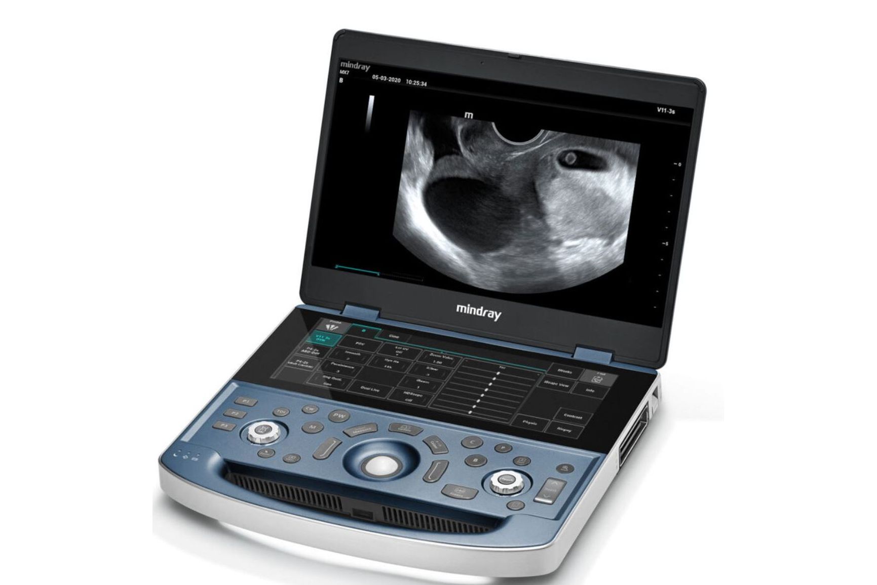 Mindray Mindray MX7
