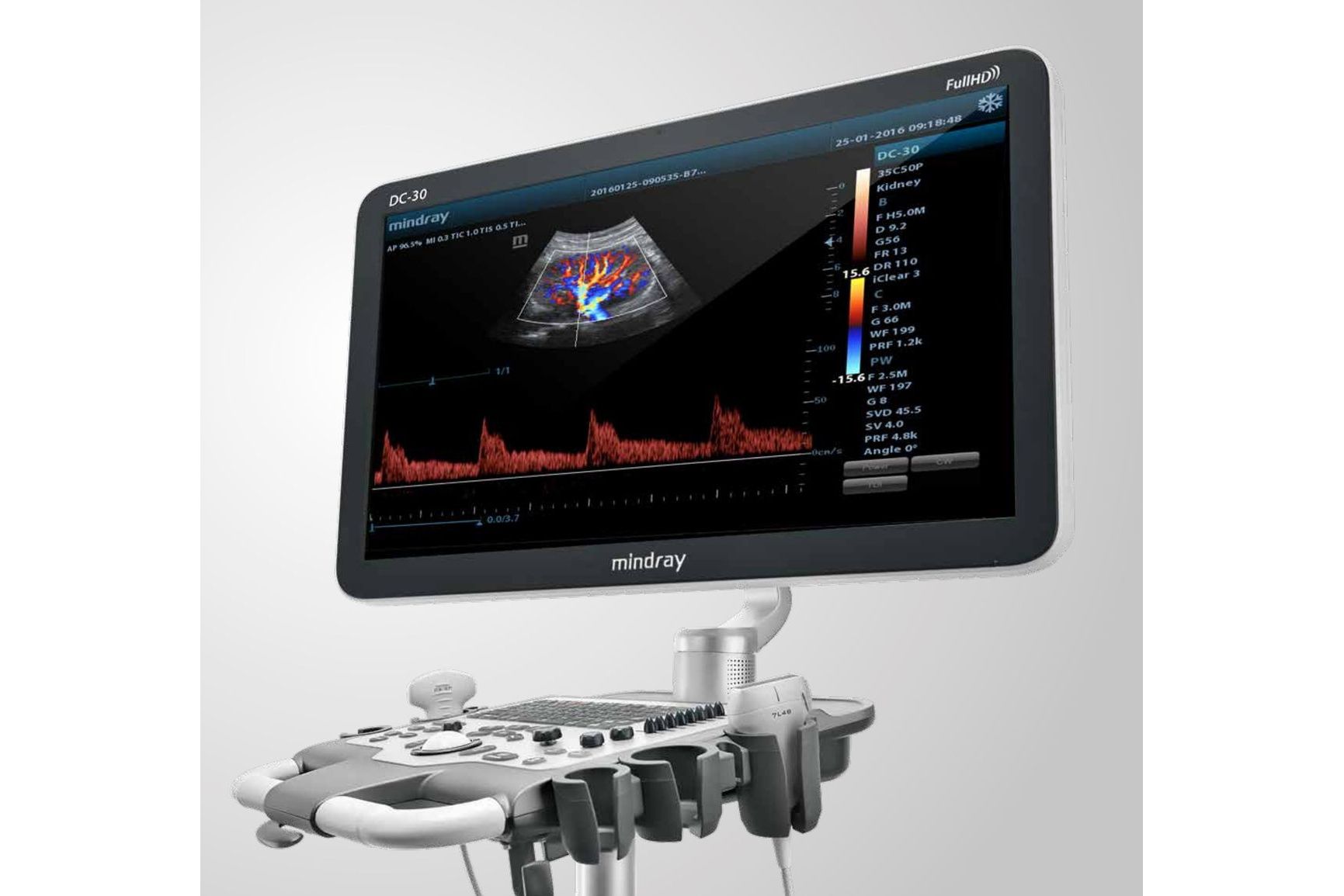 Mindray Mindray DC-30 Full HD