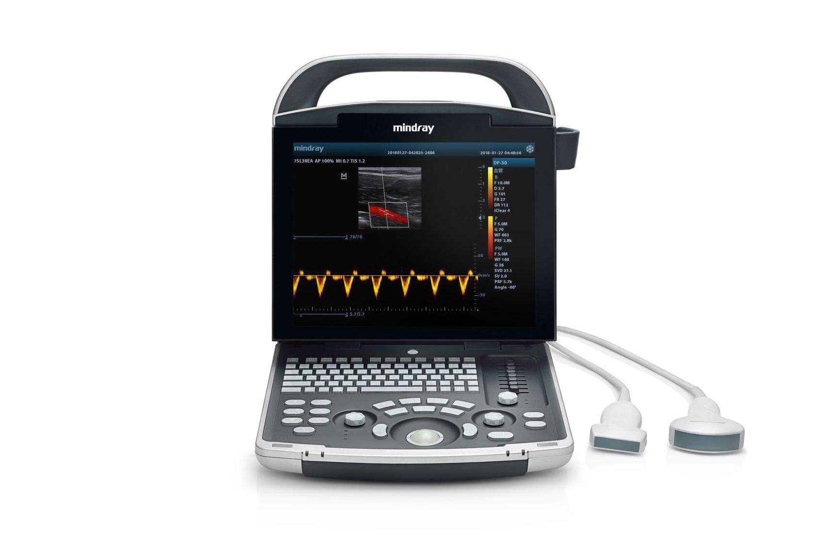 Mindray Mindray DP-30